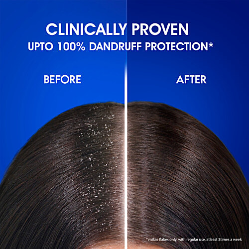 Head & Shoulder Smooth & Silky Anti Dandruff Shampoo 1 Ltr.